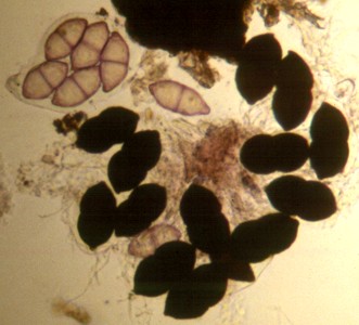 Представитель Семейства Zopfiaceae